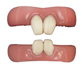 Teeth FX - Ongedierte Tanden
