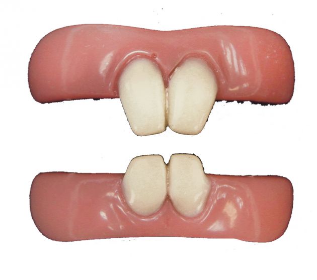 Teeth FX - Ongedierte Tanden